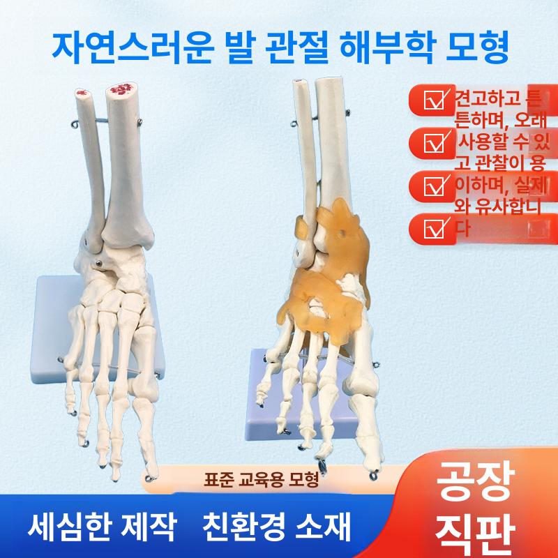 발뼈 인체모형 족골 교육용 골격 발 인대 모델 정형외과 과학 병원 복사뼈 고정형 - 상세 이미지 2
