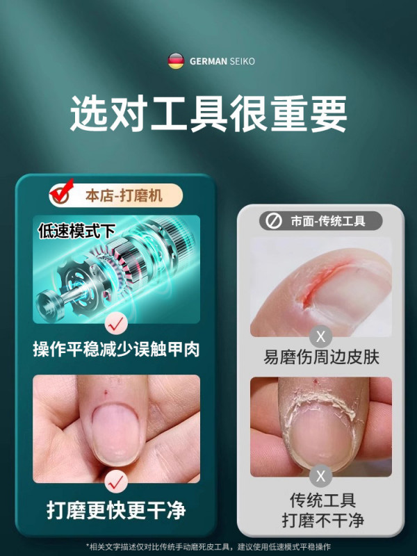 손굳은살제거 각질 전동 뒷꿈치 발가락 각질케어 - 상세 이미지 3