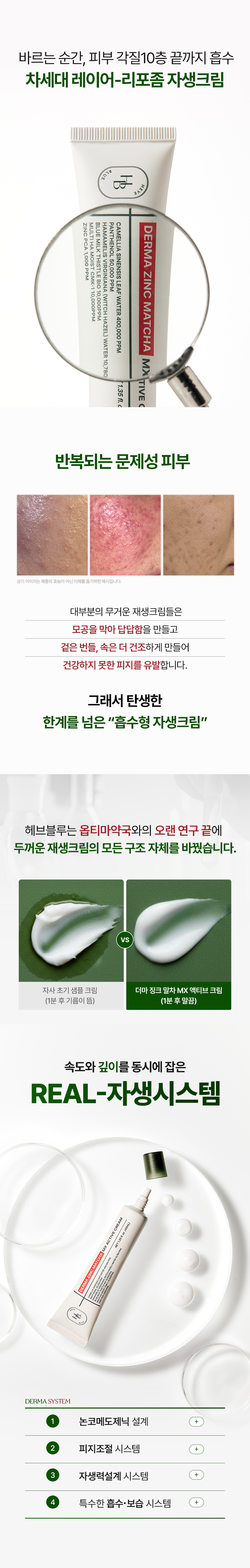 korean zinc matcha anti blemish cream
