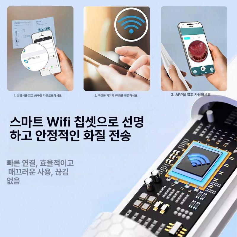 치과 카메라 구강 디지털 가정용 내시경 고화질 치아검사 입안 충치예방 덴탈 - 상세 이미지 4