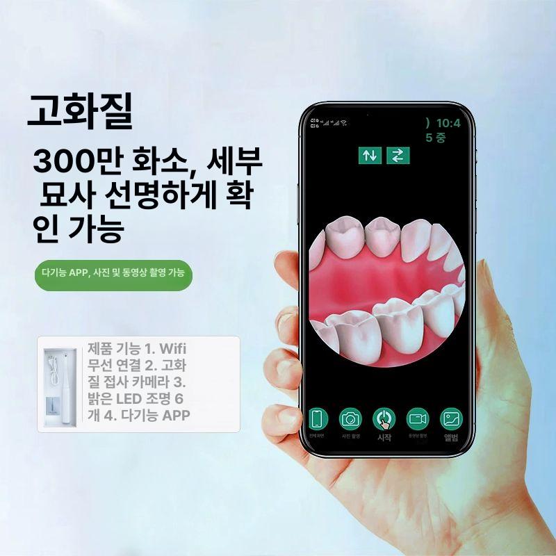치과 카메라 구강 디지털 가정용 내시경 고화질 치아검사 입안 충치예방 덴탈 - 상세 이미지 5