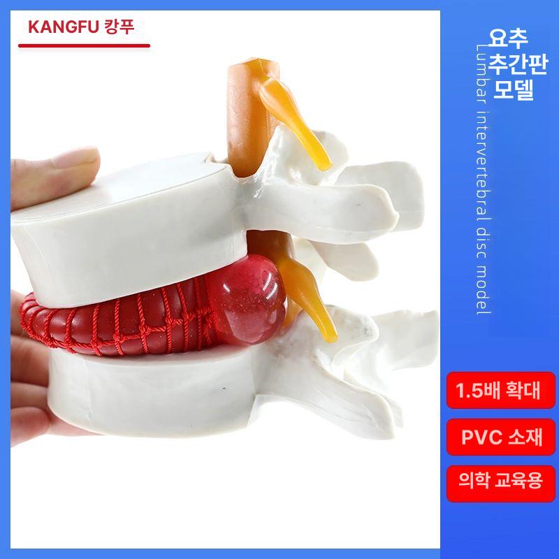 슬관절 무릎 뼈 모형 의료 교육용 해부학 근육 인대 연골 구조 학습 의학 실습 모델 - 상세 이미지 5