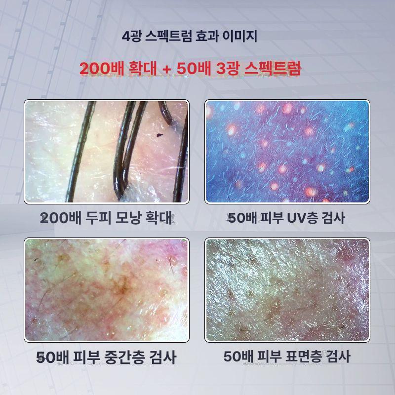휴대용 두피진단기 디지털 모발 모바일 모공 검사기 두피현미경 스캐너 모낭 전자 - 상세 이미지 5