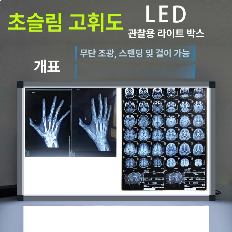 병원 엑스레이 판독대 뷰박스 관찰대 램프 라이트박스 필름판독기 반사판 의료용 조명 - 상세 이미지 2