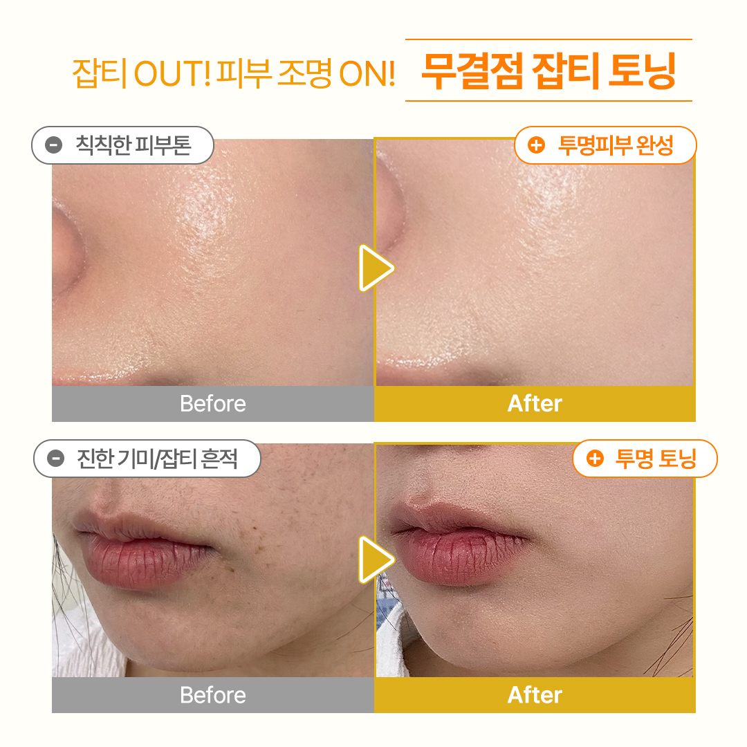 비타C 나이아신아마이드 5% 버블샷 브라이트닝/미백 앰플 1개입, 1개 - 상세 이미지 4