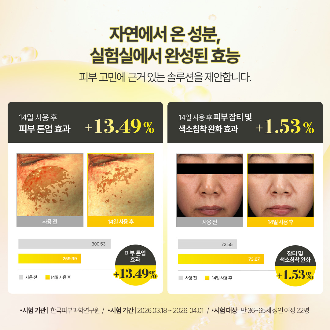 비타C 나이아신아마이드 5% 버블샷 브라이트닝/미백 앰플 1개입, 1개 - 상세 이미지 3