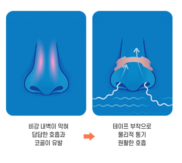 코막혔을때 러닝비강확장밴드 비강확장기 코골이완화제품 코골이방지기 - 상세 이미지 4