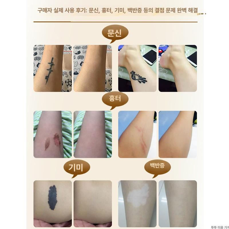 문신 가리개 커버 살색 테이프 멍 흉터 방수 스티커 스킨톤 두꺼운 10cmx2m 롤 - 상세 이미지 2