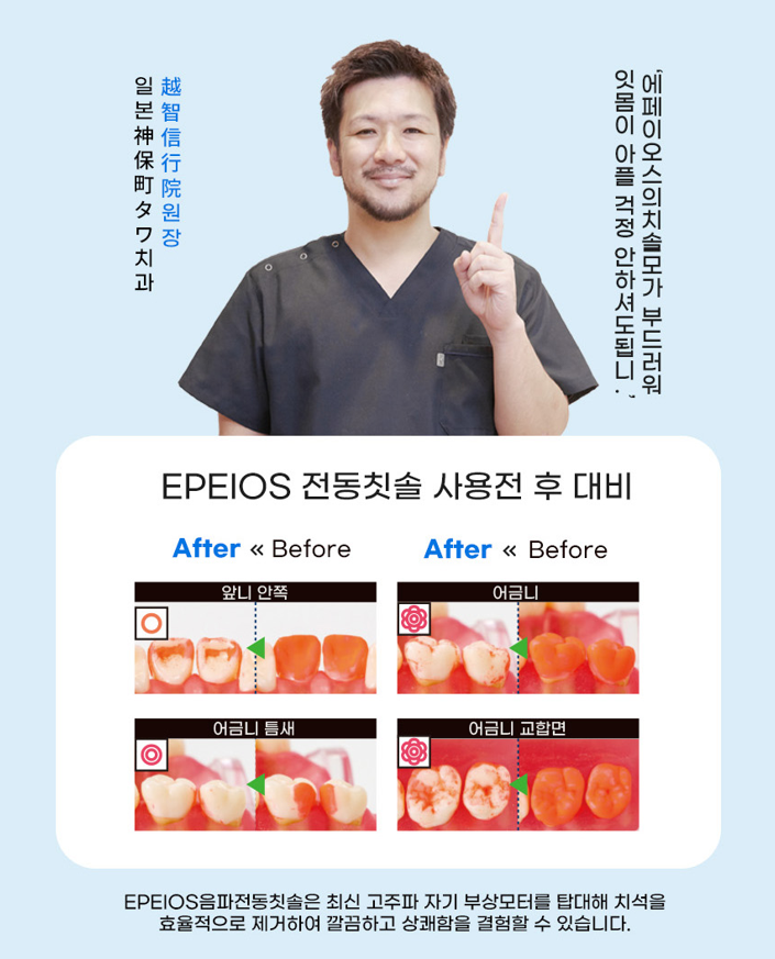 EPEIOS 에페이오스 오케아 음파 전동칫솔 올리브 그린 - 상세 이미지 4