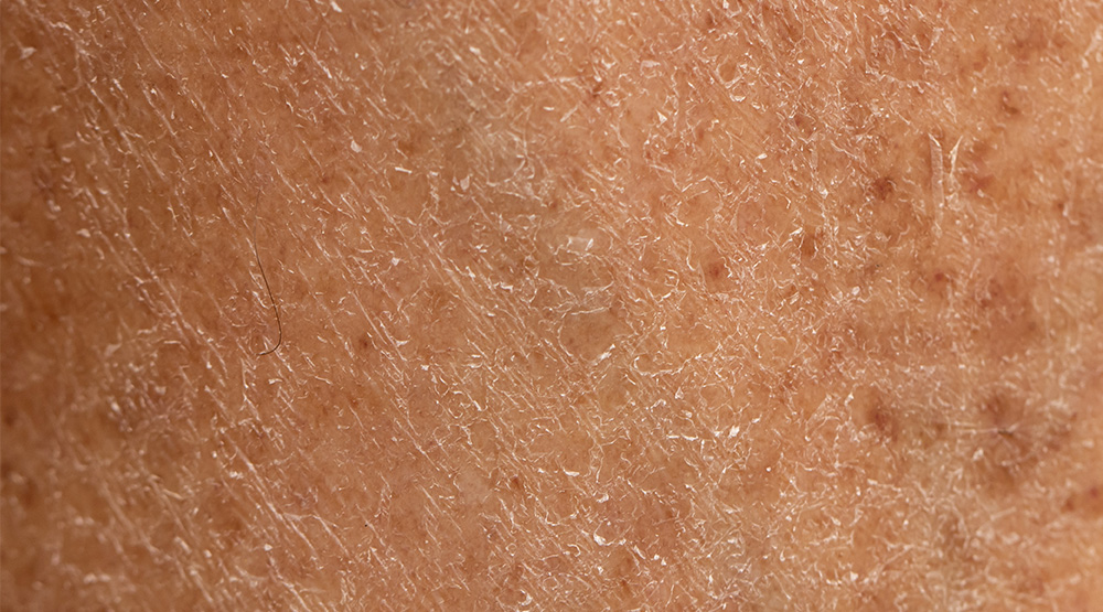 sungboon editor marine astaxanthin sheet mask