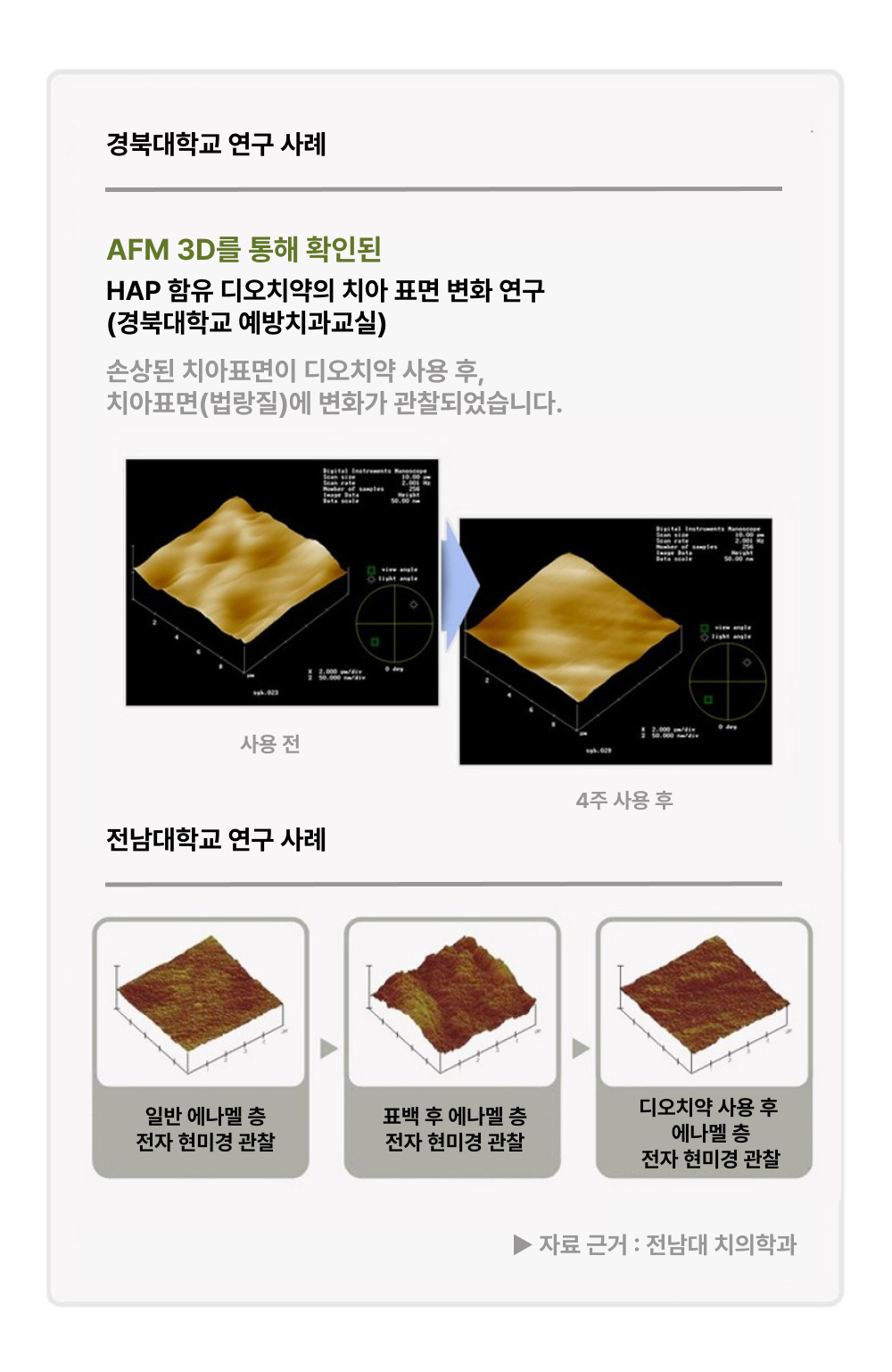 [오늘출발] 평일 2시 이전 주문 디오 미플러스 치약 민감한 치아 잇몸 구강관리 치은염예방 치과 약국 치약 100g, 3개 이미지 8