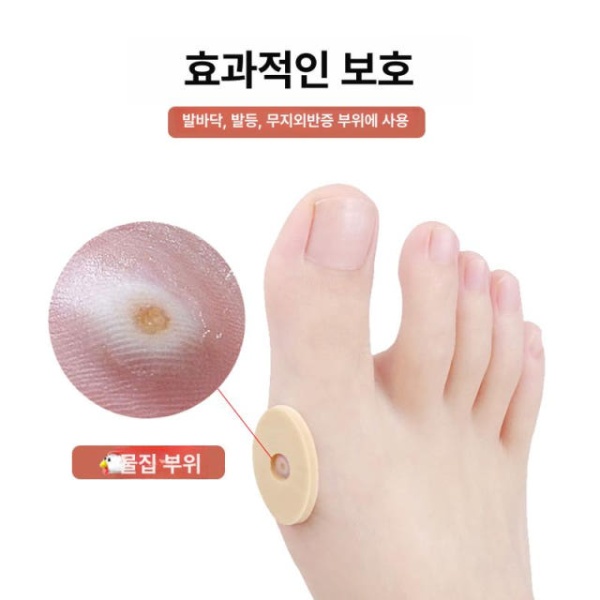 강력한 티눈밴드 타원형 뾰루지 패치 반창고 손바닥 풋케어 원형 스타일 3장 - 상세 이미지 2