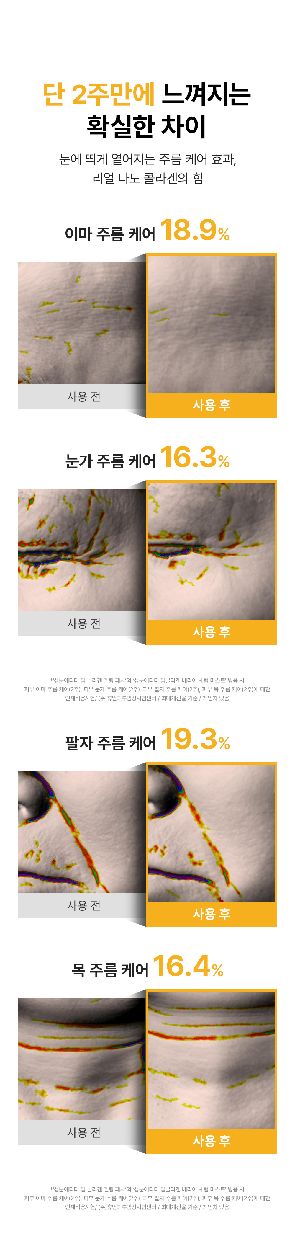 sungboon editor collagen patches