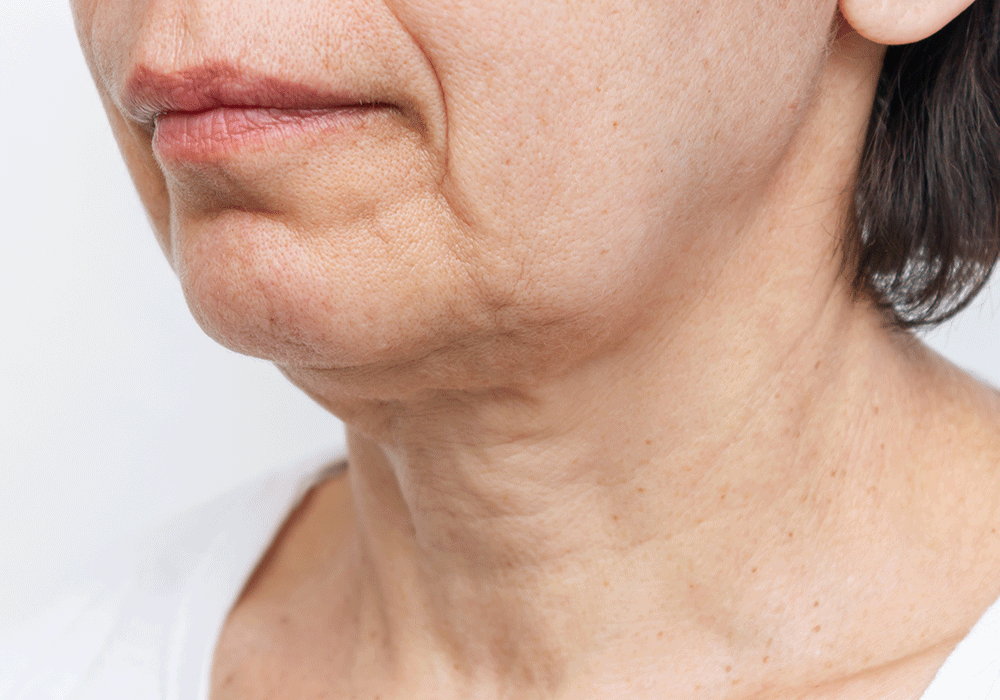 sungboon editor collagen patches