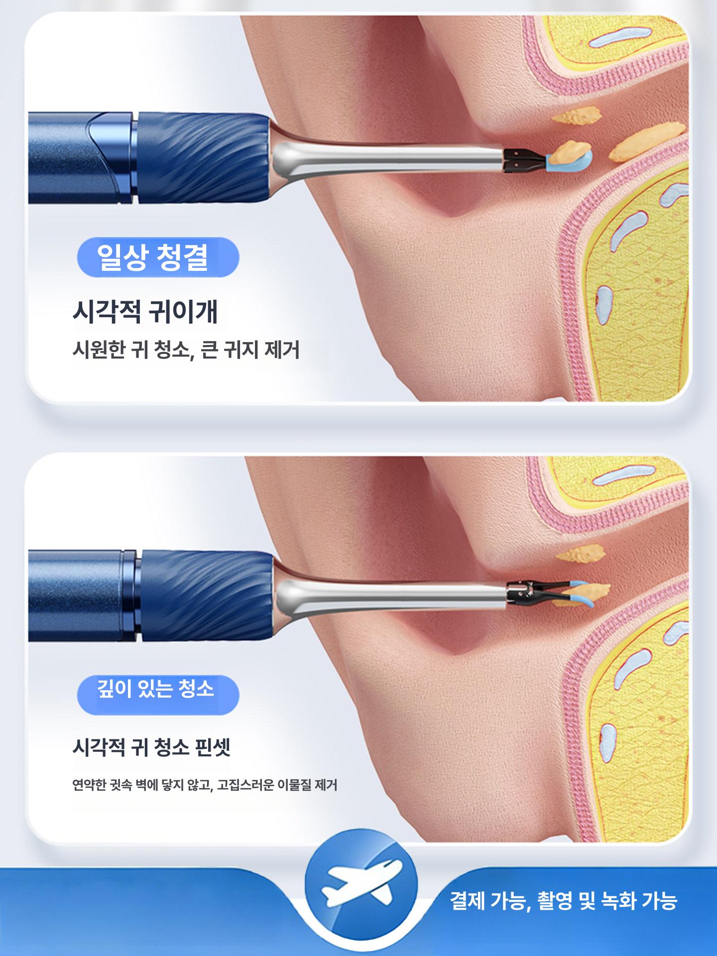 블루 현미경핀셋 카메라 피지 수리 로얄 추출 미용 지문 지능형 작업 눈썹 - 상세 이미지 3