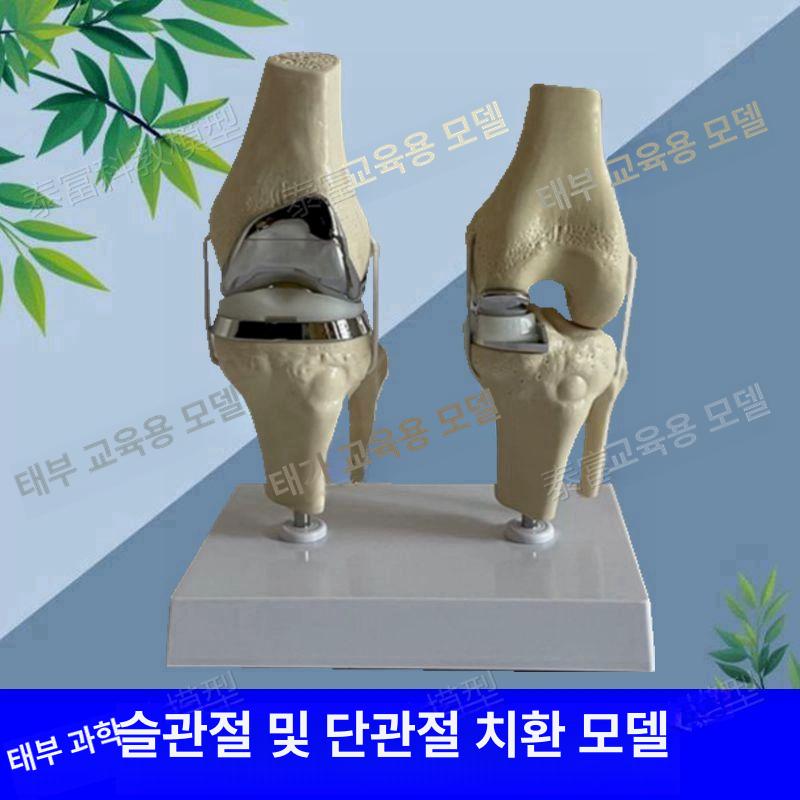 교육 무릎관절 해부학 인체모형 교체 인대 연골 모델 뼈 슬개골 인공관절 부분 구조 - 상세 이미지 2