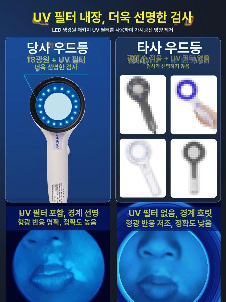 확대경 우드램프 피부검사 UV 테스터 자외선 검사기 진단 관찰 피부용 측정기 정밀 - 상세 이미지 3