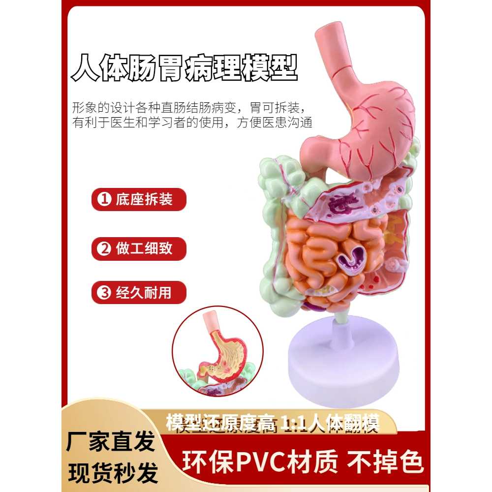 위 모형 의대 소장 수업 질환 내장 기본 장식 인테리어 시스템 내부 폐 지름 소화기관 - 상세 이미지 3