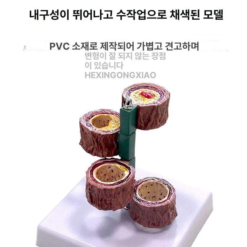 교구 심혈관모형 해부학 교육용 실습 모델 구조 의대 동맥경화 보건 정맥 심장모형 - 상세 이미지 3