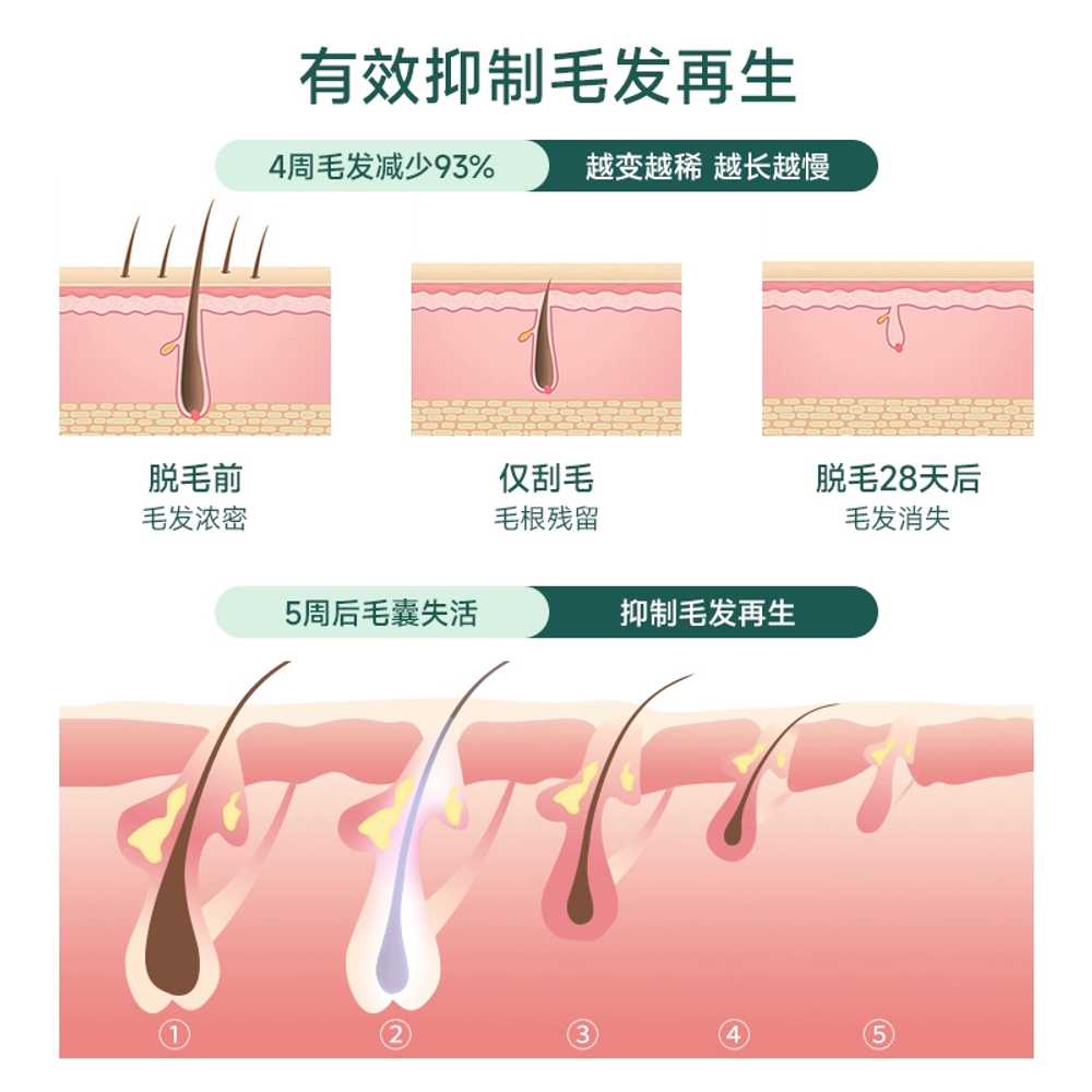 레이저제모 반영구 쿨링 숱 왁싱 정리기 셀프 브라질리언 가정용제모기 저자극 - 상세 이미지 3