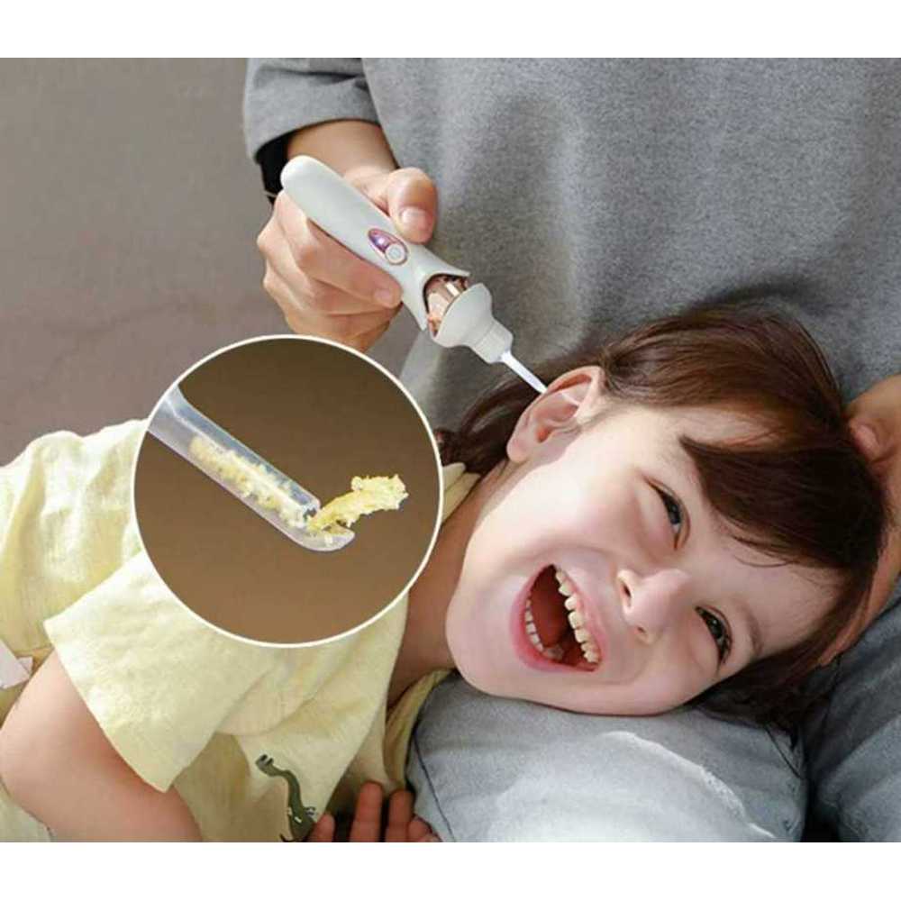 귓밥제거 LED 귀지흡입기 귀후비개 진공 귀청소기 석션 기술 전동귀이개 조명등 - 상품 이미지