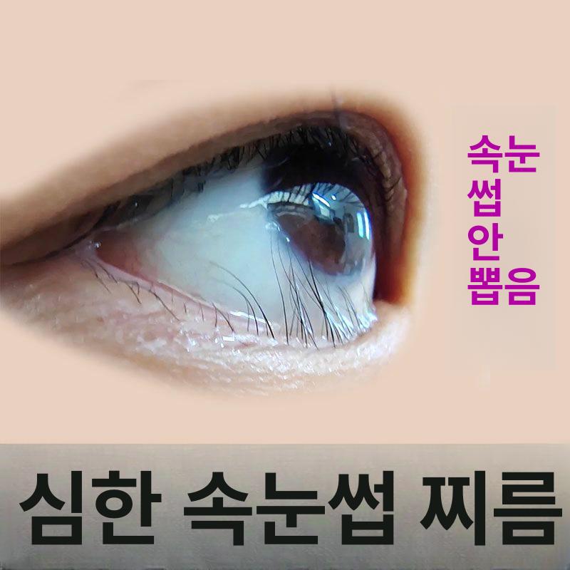 속눈썹집게 집게속눈썹고데기 컬링 메이크업 히팅뷰러 부분뷰러 언더뷰러 온도조절 - 상세 이미지 3