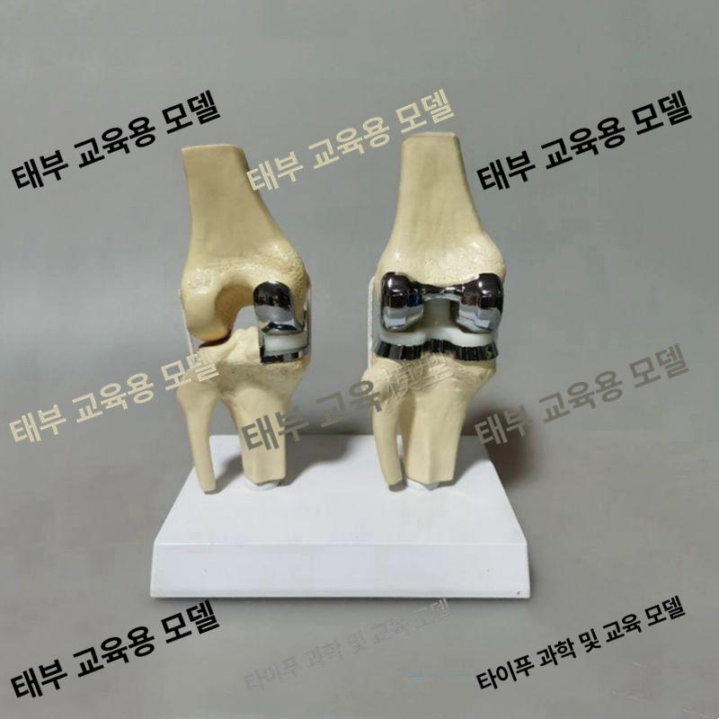교육 무릎관절 해부학 인체모형 교체 인대 연골 모델 뼈 슬개골 인공관절 부분 구조 - 상세 이미지 3