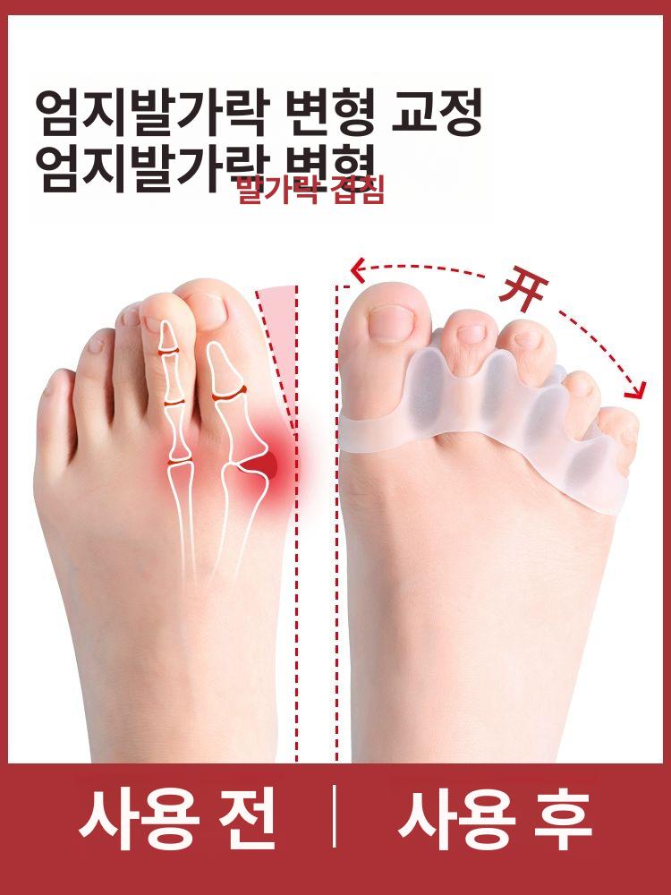 분리기 투명 교정기 벌리기 새끼발가락 3구 실리 - 상세 이미지 2