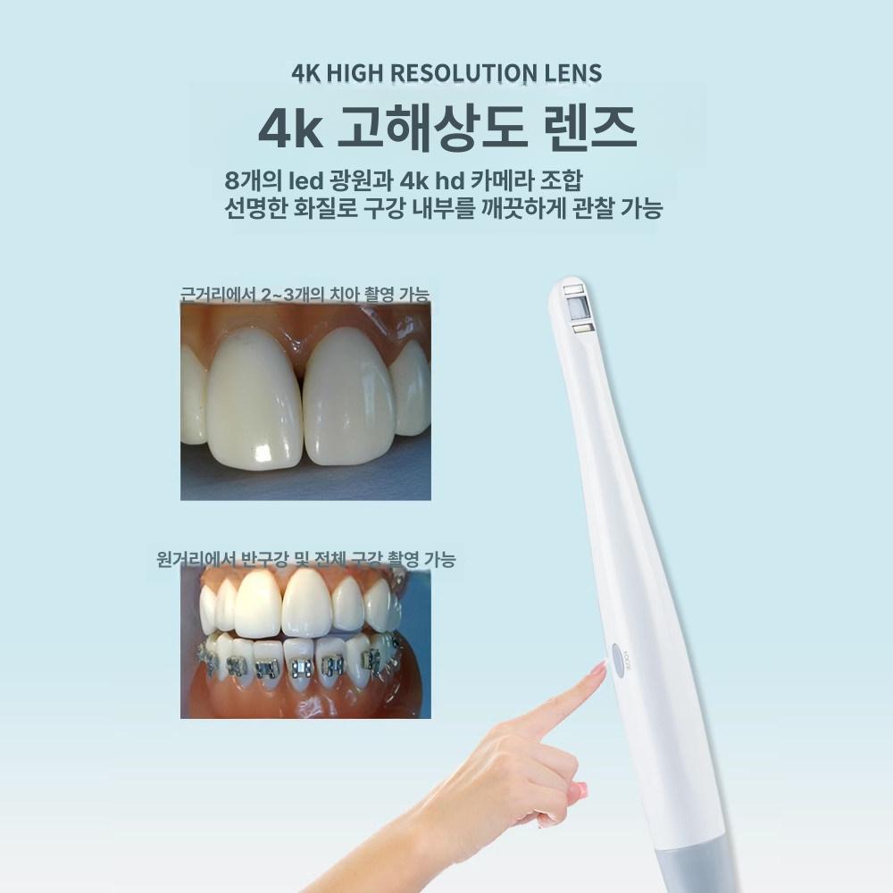 고화질 내시경 구강 무선 진료용 치과 연결 카메라 스캔 덴탈 구강내시경 치아 디스플레이 - 상세 이미지 4