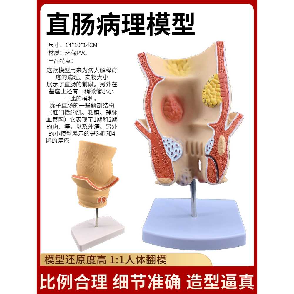 위 모형 의대 소장 수업 질환 내장 기본 장식 인테리어 시스템 내부 폐 지름 소화기관 - 상세 이미지 5