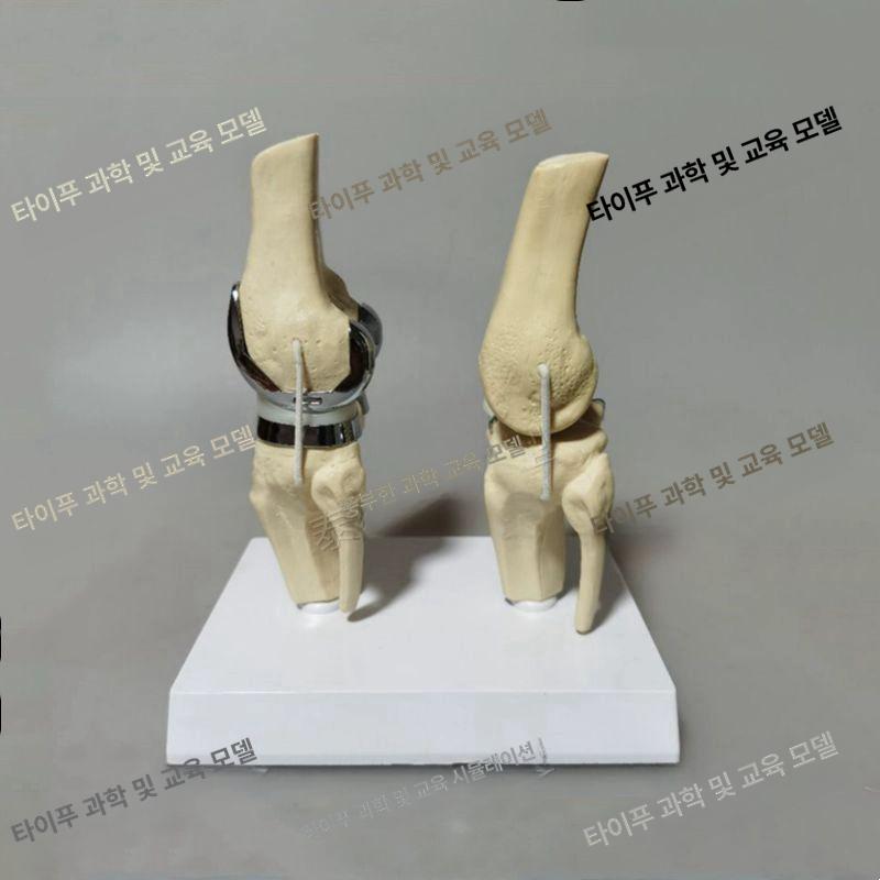 교육 무릎관절 해부학 인체모형 교체 인대 연골 모델 뼈 슬개골 인공관절 부분 구조 - 상세 이미지 5