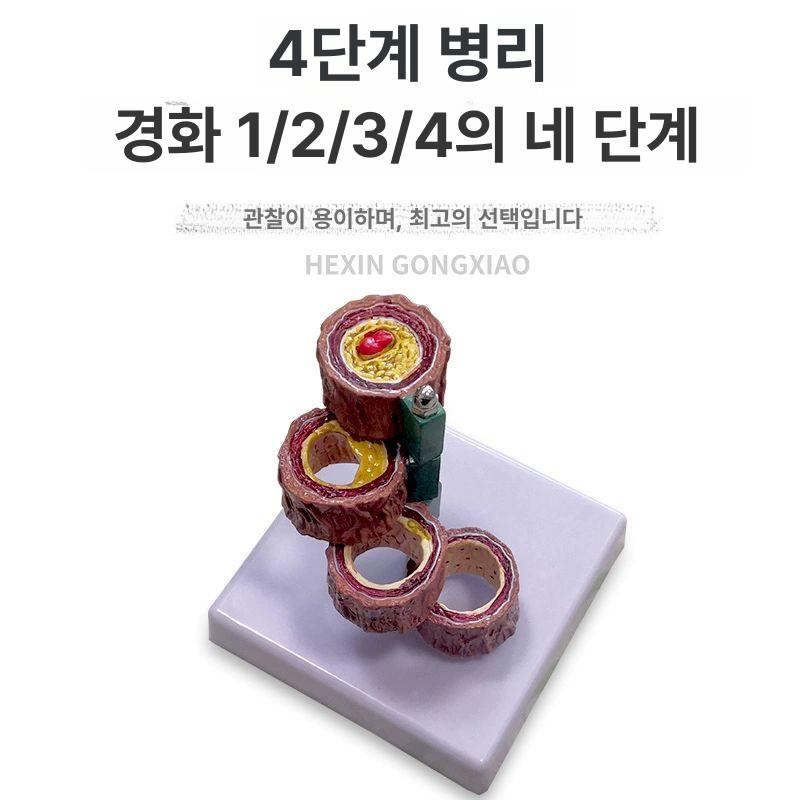 교구 심혈관모형 해부학 교육용 실습 모델 구조 의대 동맥경화 보건 정맥 심장모형 - 상세 이미지 4