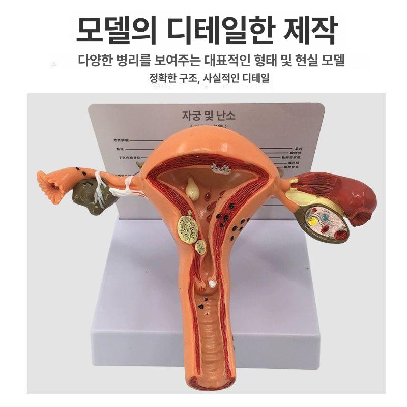 해부학 자궁모형 교육 산부인과 난소자궁 여성 인체 태아 생식기 모델 실습 신체 의학 - 상세 이미지 2