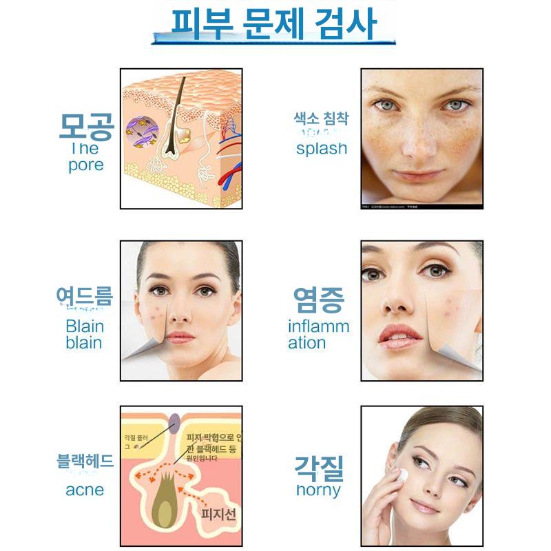 두피스캔 고배율 모공 진단기 헤어 건강 체크 디지털 검사기 확대경 - 상세 이미지 5