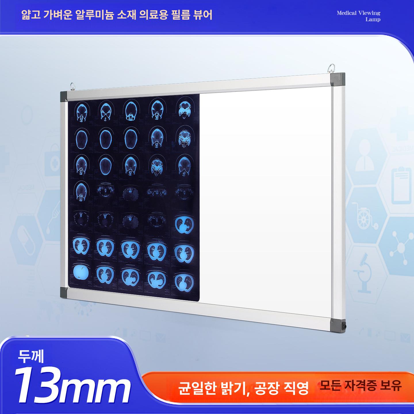 엑스레이 반사판 라이트박스 조광 조명판 의료용 판독기 디밍 고휘도 치과전용관람등 - 상세 이미지 2