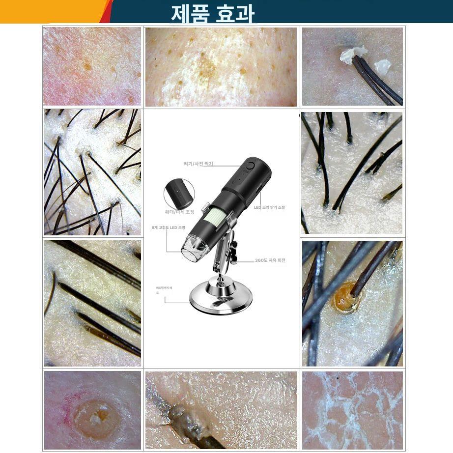 두피스캔 고배율 모공 진단기 헤어 건강 체크 디지털 검사기 확대경 - 상세 이미지 4