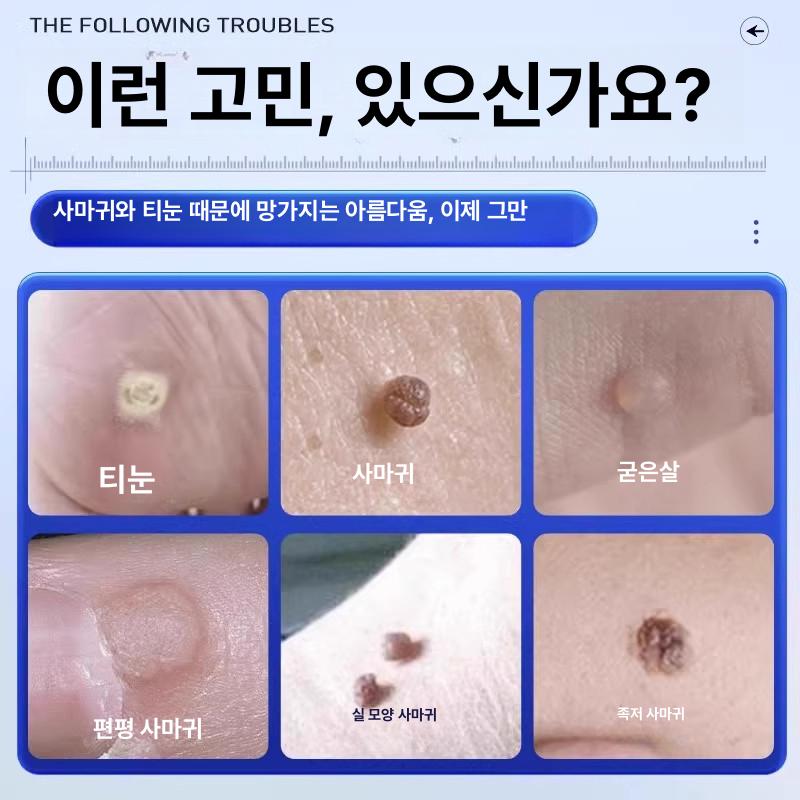 붙이는 티눈밴드 티눈 사마귀 스티커 반창고 소형사이즈 닭눈패치 1박스 12개입 - 상세 이미지 3