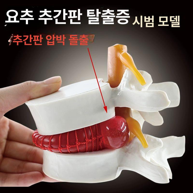척추 허리 골반 골격 뼈 모형 병원 의료 교육용 해부학 인체 모델 대퇴골 요추 - 상세 이미지 3