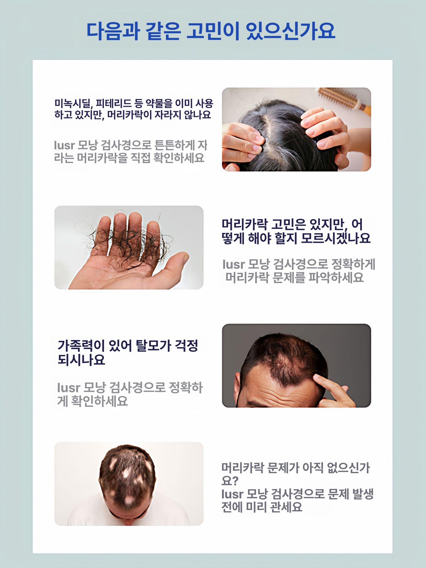 디지털 두피진단기 감정 모공 모낭 미니현미경 광학진단기 전자 관찰 - 상세 이미지 3