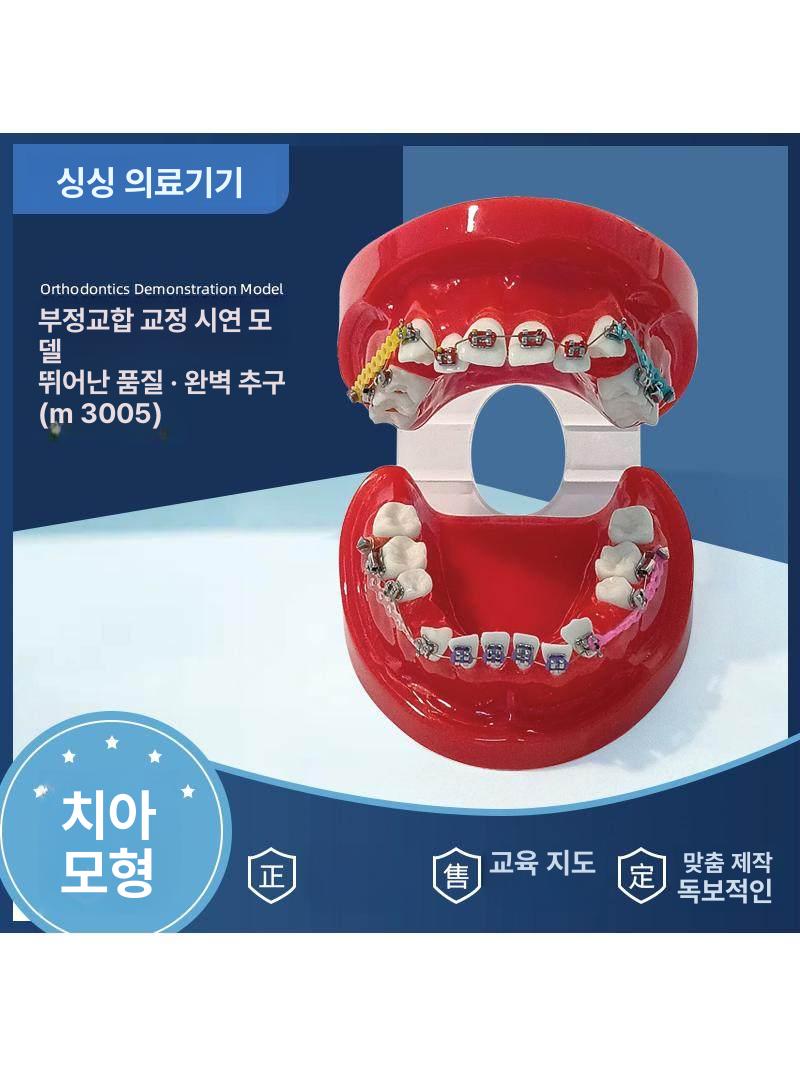 치아 모형 교육용 교구 양치 구강관리 교보재 모델 틀니 브래킷 스케일링 - 상세 이미지 2
