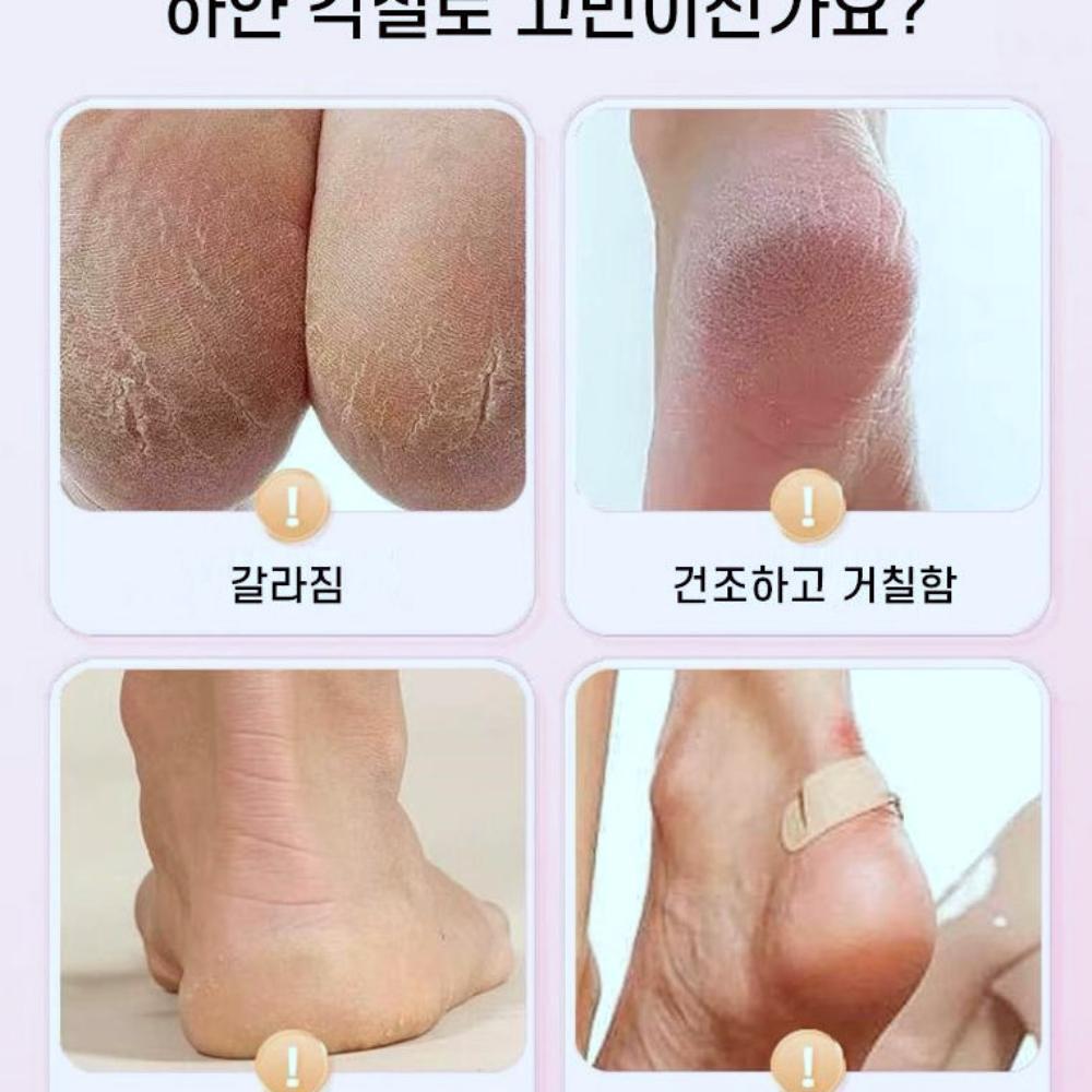 발각질 갈라짐 보습 실리콘 풋케어 양말 각질 제거기 굳은살 발뒤꿈치 관리 - 상세 이미지 2