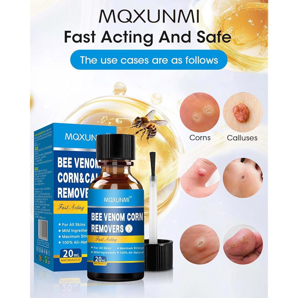 MQXUNMI 벌독 사마귀 제거제, 발 빠르게 작용하는 발용 20ML 액체 옥수수 제거제 발가락용, 엑스트라 스트렝스 사마귀, 및 굳은살 쿠션으로 안전한 관리 - 상세 이미지 3
