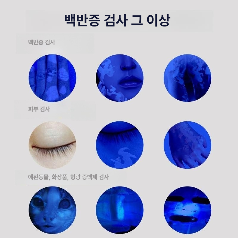 확대경 피부검사 분석 자외선 진단기 측정 필터 조명 미용용 피부용 피부과우드램프 - 상세 이미지 3