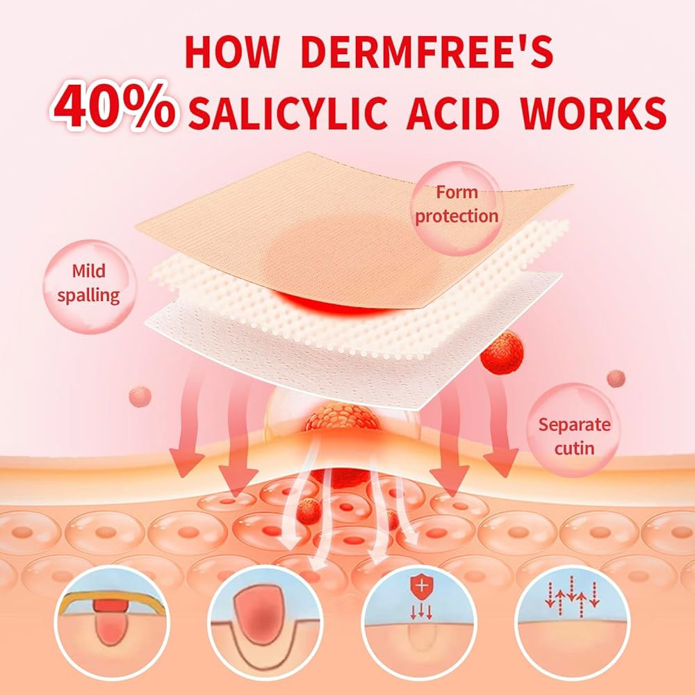 발과 발가락을 위한 DERMFREE 옥수수 제거 패드, 살리실산 40 , 빠르게 작용하는 사마귀 및 붕대로 최대 강도의 처리 42회 완료 84 Count - 상세 이미지 3