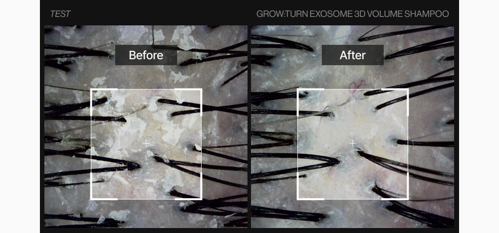 LILYEVE Growturn AD Exosome 3D Volume Shampoo - description 43