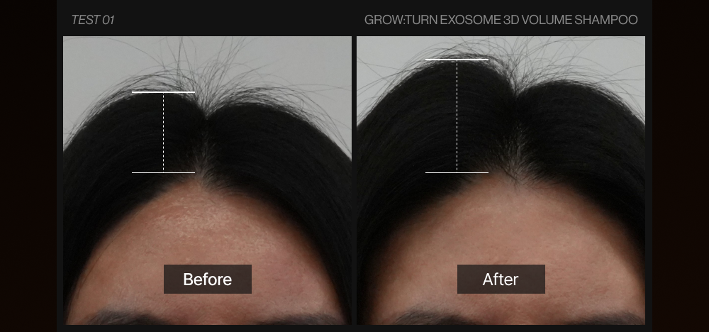 LILYEVE Growturn AD Exosome 3D Volume Shampoo - description 30