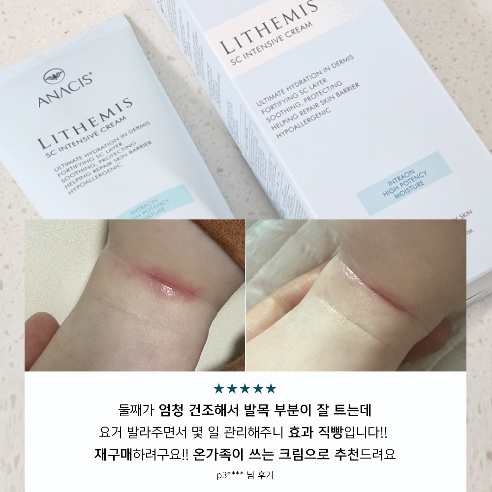 리더미스 인텐시브 MD 레이저 피부과 점뺀 후 병풀 점빼고 새살 재생 크림 연고 50g - 상세 이미지 2