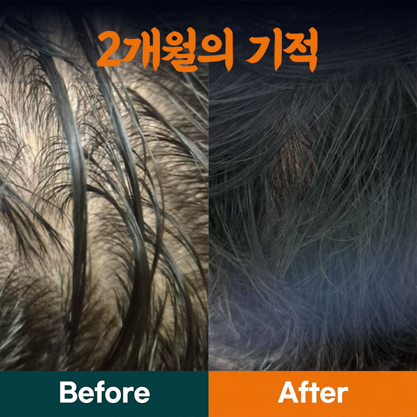 마끼라 탈모샴푸 헤어토닉 세트 탈모증상완화 두피진정 민감성모발 영양 두피케어 이미지 6