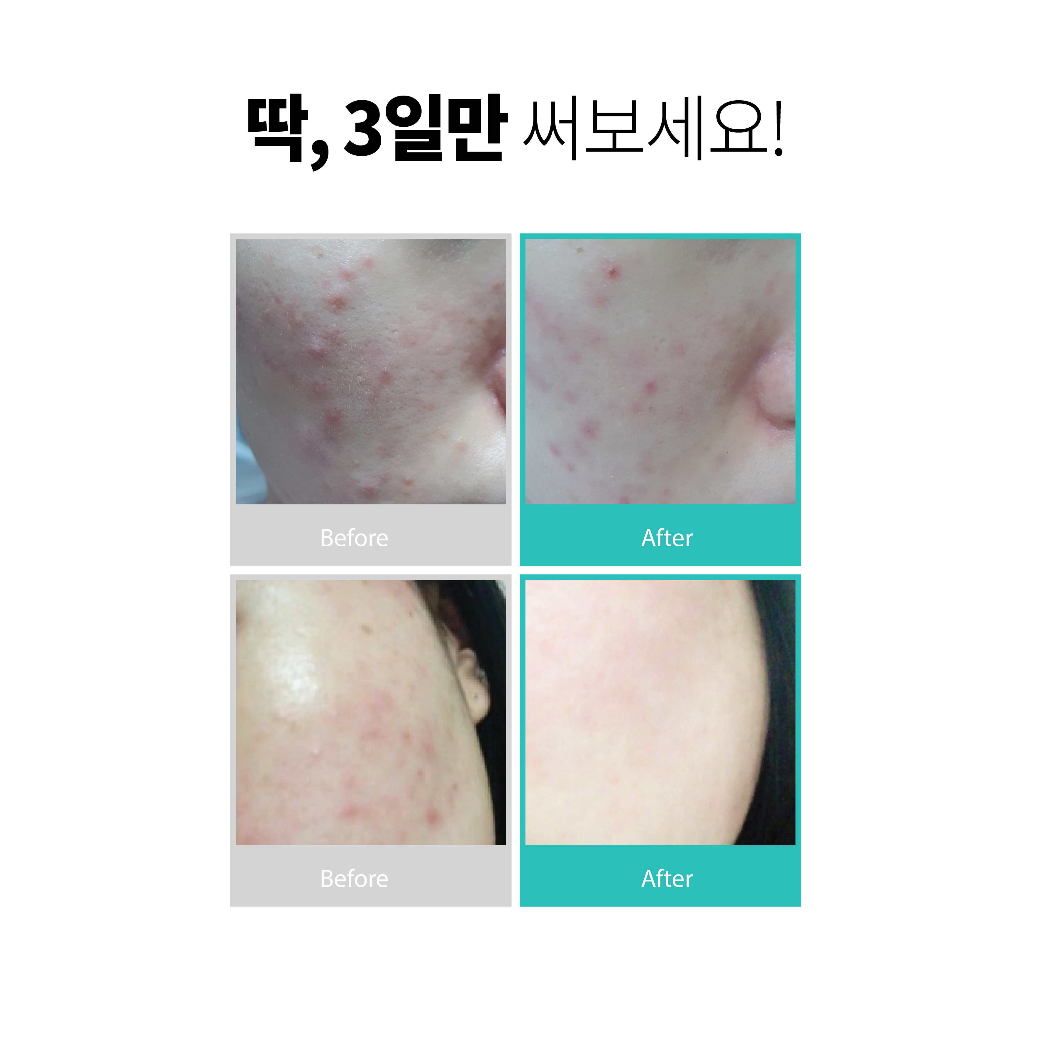 [푸딩수딩1개] 홍조 트러블 진정 수부지 진정크림 - 상세 이미지 3
