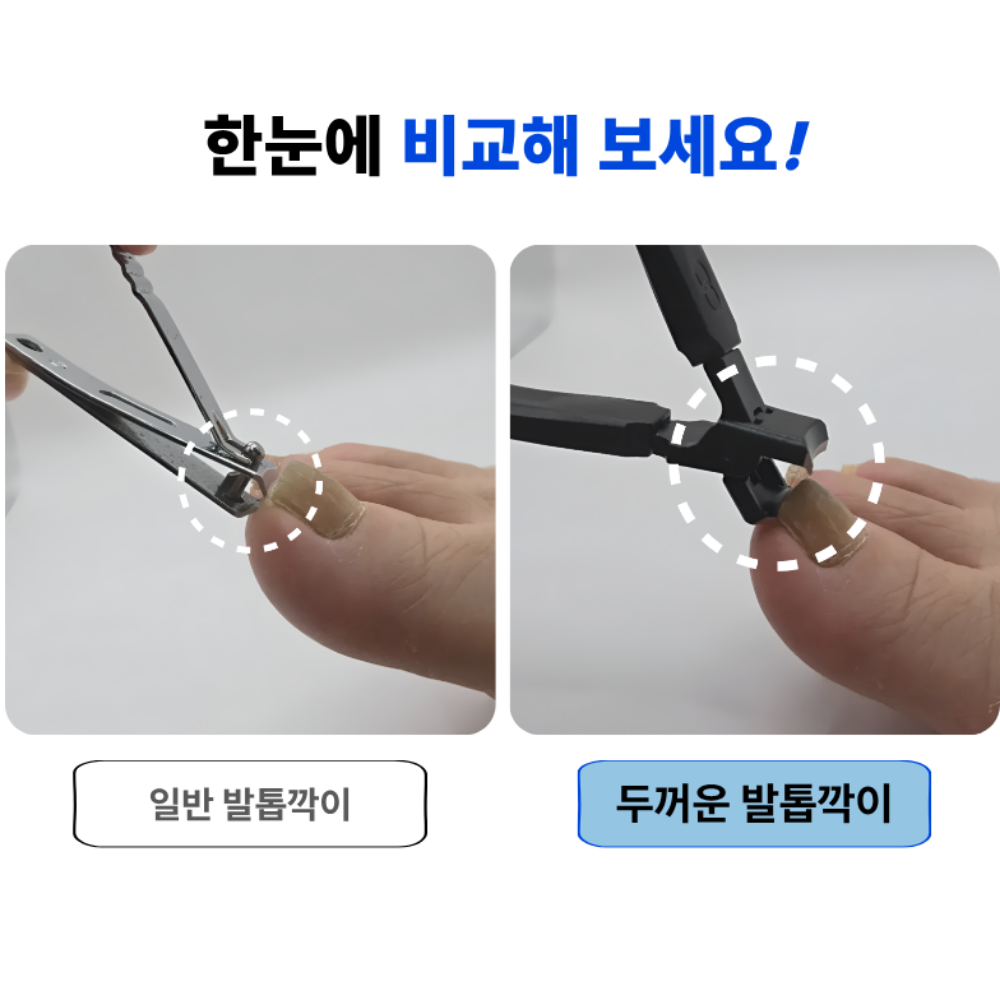 두꺼운발톱깎이 손톱깎이 대형 내성 무좀발톱깍이 관리 정리 니퍼 세트 이미지 7